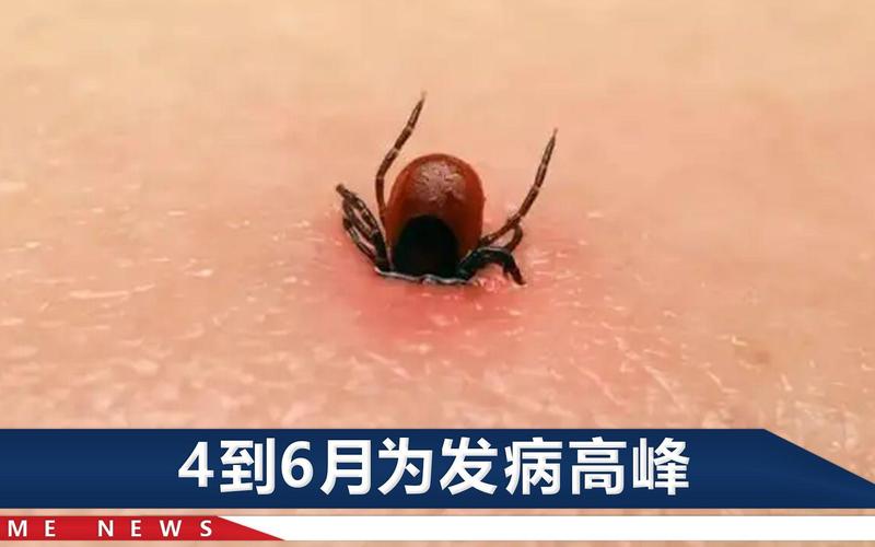 河南信阳蜱虫病疫情致 3 死 1 住院,皆因接触同一死者