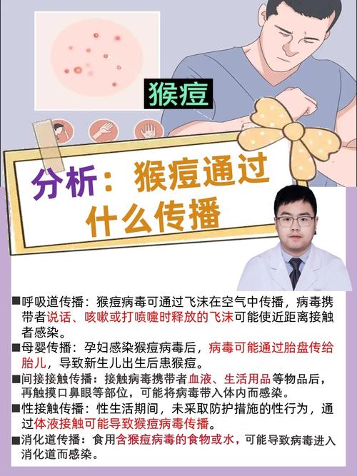 国内猴痘疫情未失控,重点人群加强防控,这些应对要点要知道